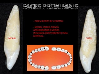 - FAZEM PONTO DE CONTATO;
- MESIAL MAIOR, MENOS
ARREDONDADA E MENOS
INCLINADA (CONVERGENTE) PARA
CERVICAL.
MESIAL DISTAL
Caíque A. Siqueira
 