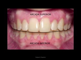 ARCADA SUPERIOR
ARCADA INFERIOR
Caíque A. Siqueira
 