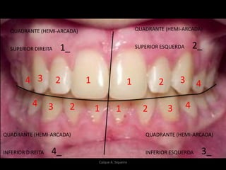 QUADRANTE (HEMI-ARCADA)
SUPERIOR DIREITA 1_
QUADRANTE (HEMI-ARCADA)
INFERIOR ESQUERDA 3_
QUADRANTE (HEMI-ARCADA)
SUPERIOR ESQUERDA 2_
QUADRANTE (HEMI-ARCADA)
INFERIOR DIREITA 4_
1
2 211
22 1 33
3 3
4 4
4 4
Caíque A. Siqueira
 