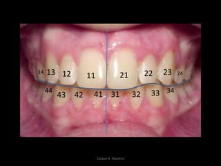 1112 21 22
314142 32
13 23 2414
343344
43
Caíque A. Siqueira
 