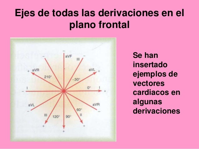 Ejes de todas las derivaciones en el
plano frontal
Se han
insertado
ejemplos de
vectores
cardiacos en
algunas
deri...