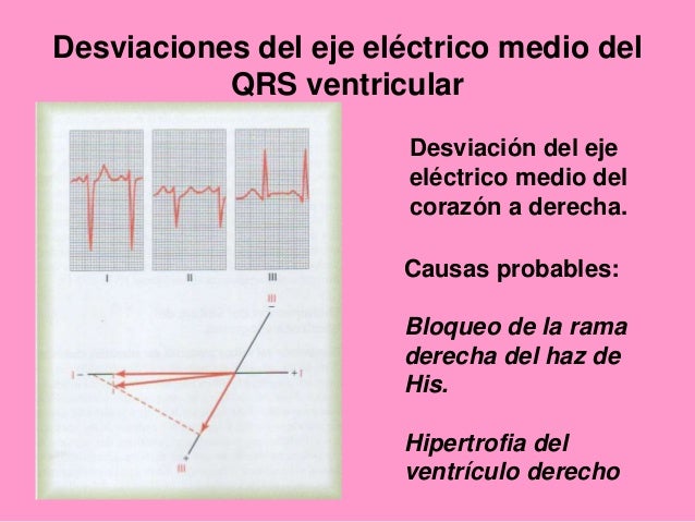 Generalidades electrocardiograma