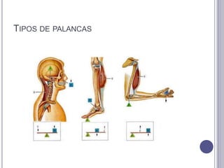 TENOSUSPENSIÓN
 Colocación de una
articulación en
posición funcional por
medio de tendones
que no tiene actividad
funcion...