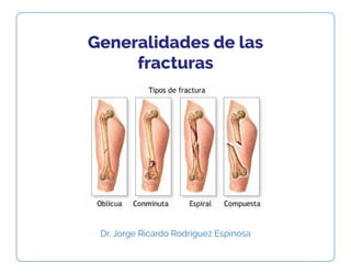 Generalidades de las
fracturas
Dr. Jorge Ricardo Rodriguez Espinosa
 