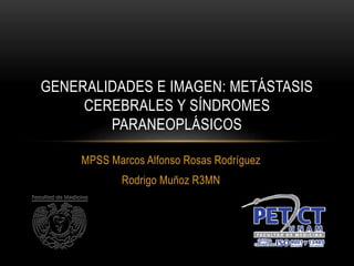 MPSS Marcos Alfonso Rosas Rodríguez
Rodrigo Muñoz R3MN
GENERALIDADES E IMAGEN: METÁSTASIS
CEREBRALES Y SÍNDROMES
PARANEOPLÁSICOS
 