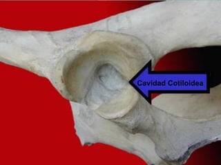 Cavidad Cotiloidea
 