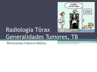 Radiología Tórax
Generalidades Tumores, TB
Moctezuma Cabrera Salaiza

 
