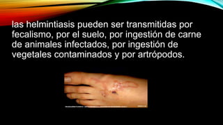 las helmintiasis pueden ser transmitidas por
fecalismo, por el suelo, por ingestión de carne
de animales infectados, por ingestión de
vegetales contaminados y por artrópodos.
 