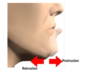 Protrusion
Retrusion
 