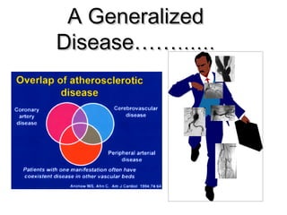 AA GGeenneerraalliizzeedd 
DDiisseeaassee…………………… 
 