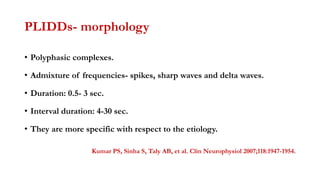 PLIDDs- morphology
• Polyphasic complexes.
• Admixture of frequencies- spikes, sharp waves and delta waves.
• Duration: 0.5- 3 sec.
• Interval duration: 4-30 sec.
• They are more specific with respect to the etiology.
Kumar PS, Sinha S, Taly AB, et al. Clin Neurophysiol 2007;118:1947-1954.
 