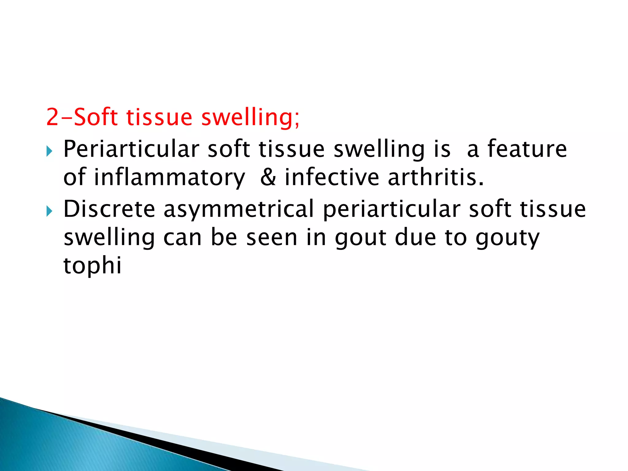 Plain film signs indicating presence of arthritis