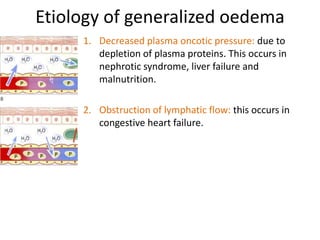 Etiology of generalized oedemaDecreased plasma oncotic pressure: due to depletion of plasma proteins. This occurs in nephrotic syndrome, liver failure and malnutrition.Obstruction of lymphatic flow: this occurs in congestive heart failure.