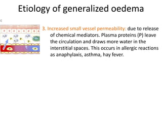 Etiology of generalized oedema3. Increased small vessel permeability: due to release of chemical mediators. Plasma proteins (P) leave the circulation and draws more water in the interstitial spaces. This occurs in allergic reactions as anaphylaxis, asthma, hay fever.