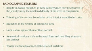 RADIOGRAPHIC FEATURES
• Results in overall reduction in bone density,which may be observed in
the jaws by using the unaltered density of the teeth in comparison.
• Thinning of the cortical boundaries of the inferior mandibular cortex
• Reduction in the volume of cancellous bone
• Lamina dura appear thinner than normal
• Anatomical shadows such as the nasal fossa and maxillary sinus are
less distinct
• Wedge shaped appearance of the effected vertebrae
 
