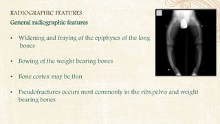 RADIOGRAPHIC FEATURES
General radiographic features
• Widening and fraying of the epiphyses of the long
bones
• Bowing of the weight bearing bones
• Bone cortex may be thin
• Pseudofractures occurs most commonly in the ribs,pelvis and weight
bearing bones.
 