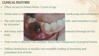 CLINICAL FEATURES
• Often occurs in infants below 3 years of age
• Initial onset is manifested as skin rash involving the trunk,scalp and extremities.
• The rash may be erythematous,purpuric and ecchymotic and sometimes it may
be ulcerative.
• Soft tissue and bony granulomatous lesions are disseminated through out the
body.
• Oral cavity is affected with multiple ulcers and enlargement of gingival tissues.
• Diffuse destruction of maxilla and mandible leading to loosening and
premature loss of teeth.
 