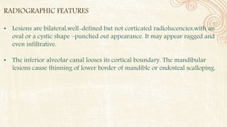 RADIOGRAPHIC FEATURES
• Lesions are bilateral,well-defined but not corticated radiolucencies,with an
oval or a cystic shape –punched out appearance. It may appear ragged and
even infiltrative.
• The inferior alveolar canal looses its cortical boundary. The mandibular
lesions cause thinning of lower border of mandible or endosteal scalloping.
 