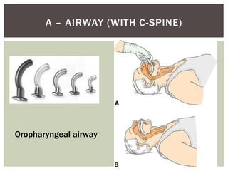 General management of trauma | PPTX