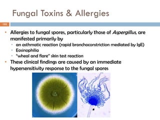 Fungal Toxins & Allergies
152
• Allergies to fungal spores, particularly those of Aspergillus, are
manifested primarily by
• an asthmatic reaction (rapid bronchoconstriction mediated by IgE)
• Eosinophilia
• “wheal and flare” skin test reaction
• These clinical findings are caused by an immediate
hypersensitivity response to the fungal spores
 