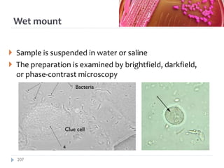 Wet mount
 Sample is suspended in water or saline
 The preparation is examined by brightfield, darkfield,
or phase-contrast microscopy
Clue cell
Bacteria
207
 