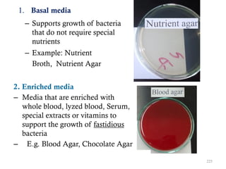 1. Basal media
– Supports growth of bacteria
that do not require special
nutrients
– Example: Nutrient
Broth, Nutrient Agar
2. Enriched media
– Media that are enriched with
whole blood, lyzed blood, Serum,
special extracts or vitamins to
support the growth of fastidious
bacteria
– E.g. Blood Agar, Chocolate Agar
225
 