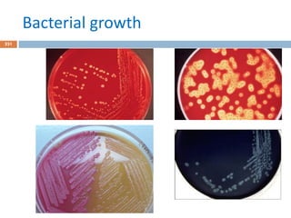Bacterial growth
231
 
