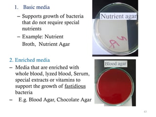 1. Basic media
– Supports growth of bacteria
that do not require special
nutrients
– Example: Nutrient
Broth, Nutrient Agar
2. Enriched media
– Media that are enriched with
whole blood, lyzed blood, Serum,
special extracts or vitamins to
support the growth of fastidious
bacteria
– E.g. Blood Agar, Chocolate Agar
83
 