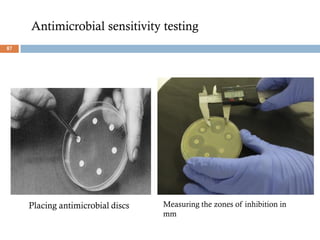Placing antimicrobial discs Measuring the zones of inhibition in
mm
Antimicrobial sensitivity testing
87
 