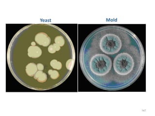147
Yeast Mold
 