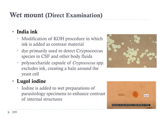 Wet mount (Direct Examination)
209
• India ink
• Modification of KOH procedure in which
ink is added as contrast material
• dye primarily used to detect Cryptococcus
species in CSF and other body fluids
• polysaccharide capsule of Cryptococcus spp.
excludes ink, creating a halo around the
yeast cell
• Lugol iodine
• Iodine is added to wet preparations of
parasitology specimens to enhance contrast
of internal structures
 