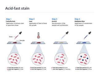 Acid-fast stain
215
 