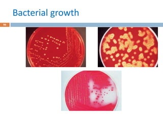 Bacterial growth
86
 