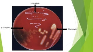 α-hemolytic
β-hemolytic
γ-hemolytic
 