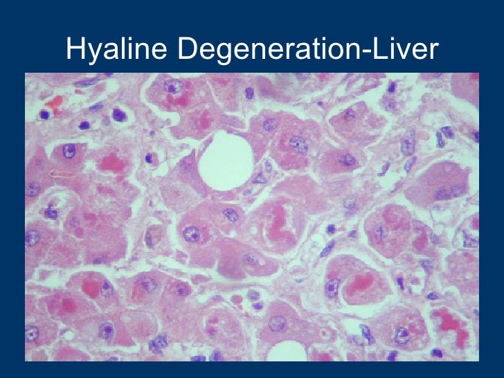 General pathology lecture 1 introduction &amp; cell injury