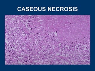 General pathology lecture 3 cell death or necrosis | PPT