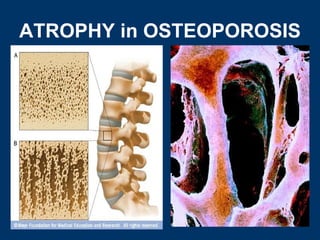 General pathology lecture 4 cellular adaptation | PPT