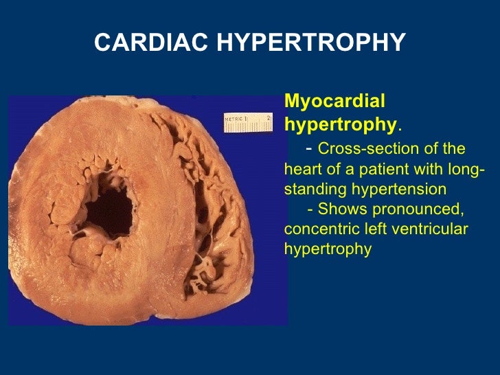 General pathology lecture 4 cellular adaptation