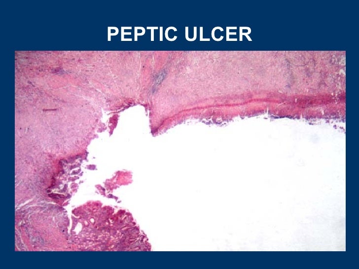 General pathology lecture 5 inflammation & repair