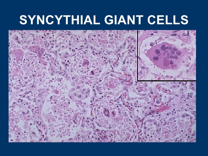 General pathology lecture 5 inflammation & repair