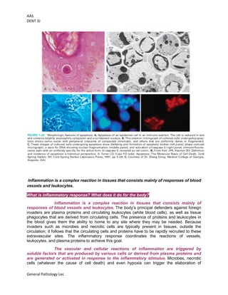 AAS
DENT 3J
General Pathology Lec
Inflammation is a complex reaction in tissues that consists mainly of responses of blood
vessels and leukocytes.
What is inflammatory response? What does it do for the body?
Inflammation is a complex reaction in tissues that consists mainly of
responses of blood vessels and leukocytes. The body’s principal defenders against foreign
invaders are plasma proteins and circulating leukocytes (white blood cells), as well as tissue
phagocytes that are derived from circulating cells. The presence of proteins and leukocytes in
the blood gives them the ability to home to any site where they may be needed. Because
invaders such as microbes and necrotic cells are typically present in tissues, outside the
circulation, it follows that the circulating cells and proteins have to be rapidly recruited to these
extravascular sites. The inflammatory response coordinates the reactions of vessels,
leukocytes, and plasma proteins to achieve this goal.
The vascular and cellular reactions of inflammation are triggered by
soluble factors that are produced by various cells or derived from plasma proteins and
are generated or activated in response to the inflammatory stimulus. Microbes, necrotic
cells (whatever the cause of cell death) and even hypoxia can trigger the elaboration of
 