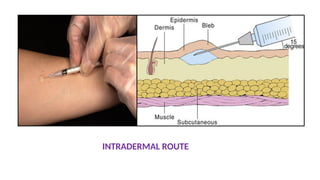 INTRADERMAL ROUTE
 