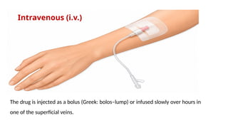 Intravenous (i.v.)
The drug is injected as a bolus (Greek: bolos–lump) or infused slowly over hours in
one of the superficial veins.
 