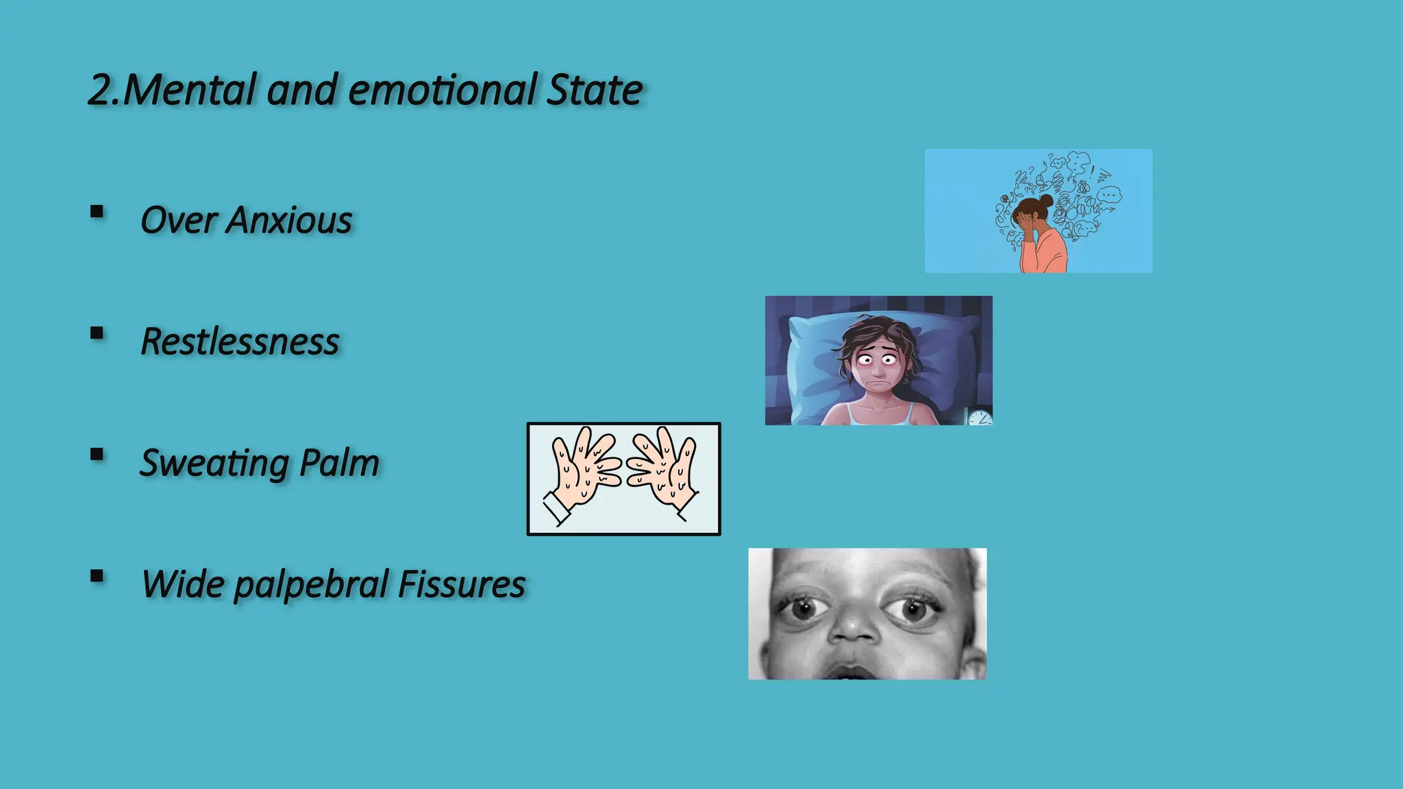2.Mental and emotional State
 Over Anxious
 Restlessness
 Sweating Palm
 Wide palpebral Fissures
 