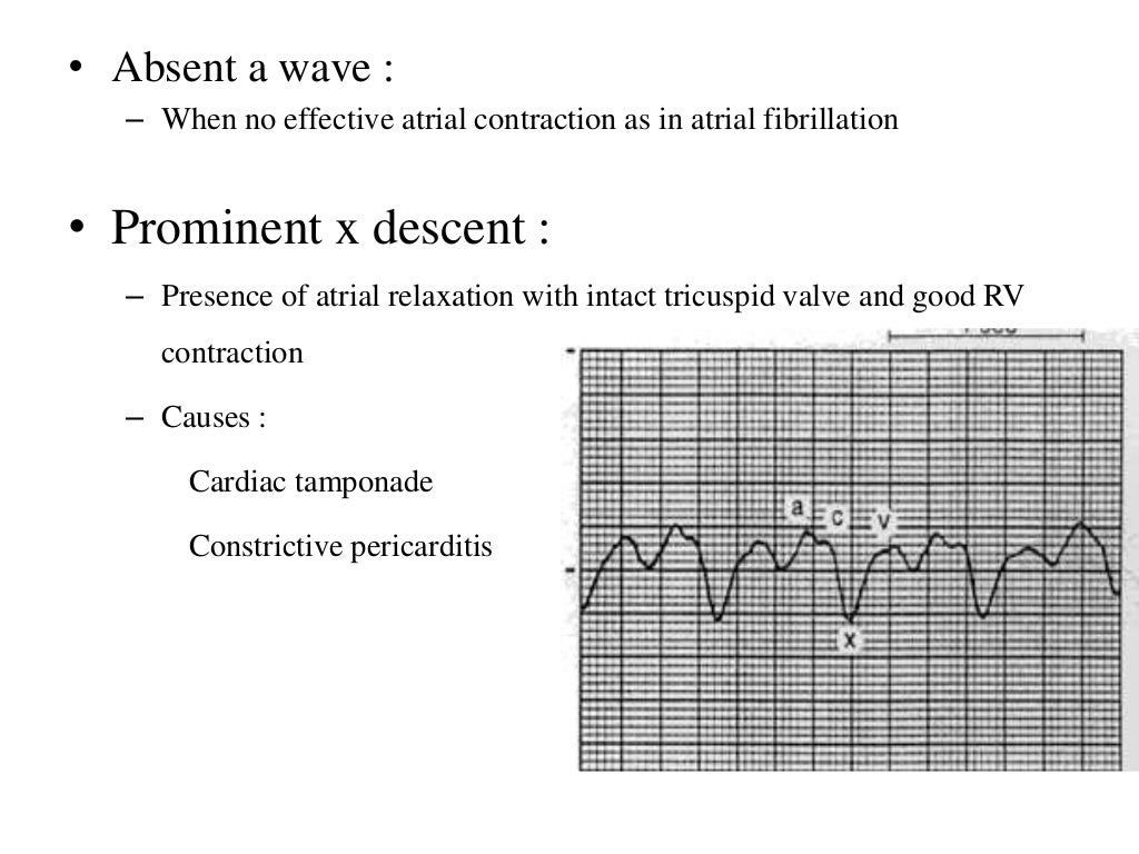 General physical examination of CVS