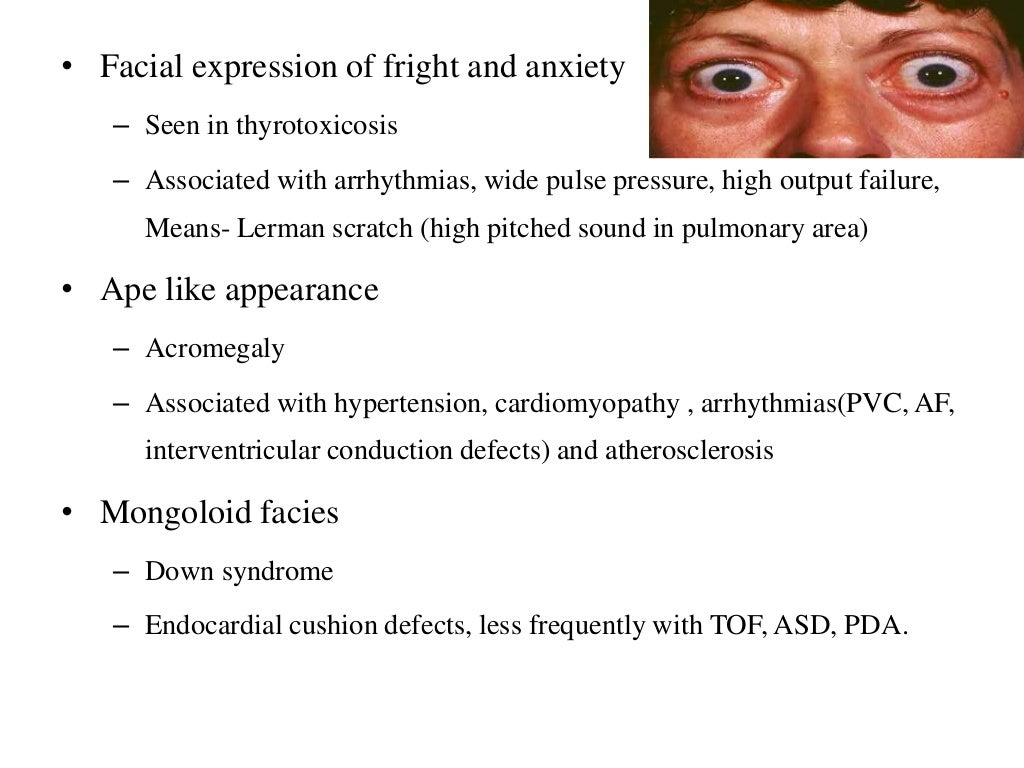 General physical examination of CVS