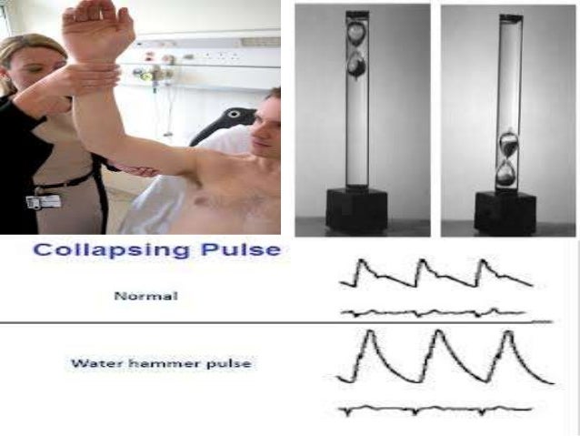 General physical examination of cvs 