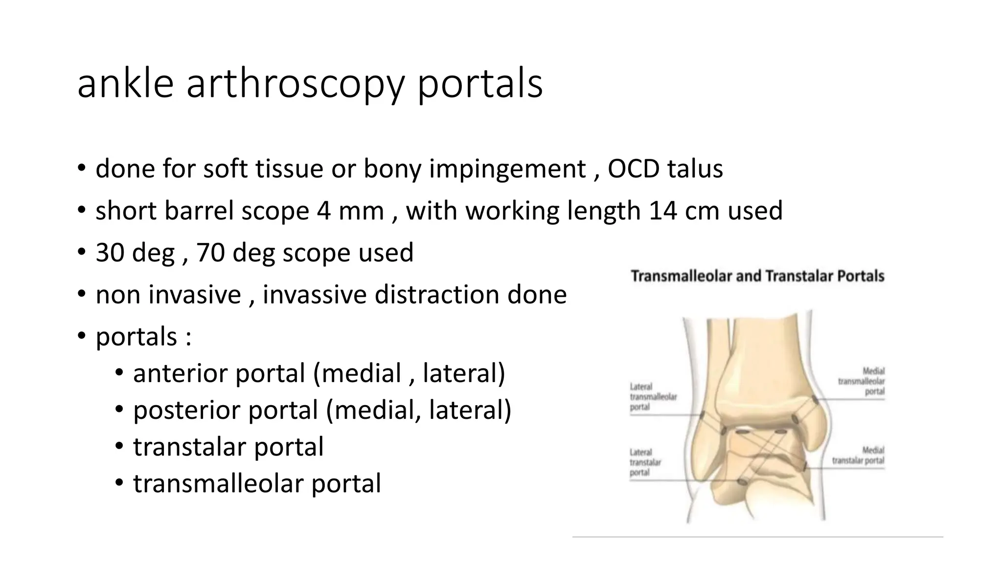 Talus Tree Scope General Principles of Arthroscopy Pramesh.pptx