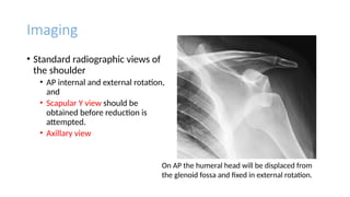 General principles of fracture and dislocation (2).pptx