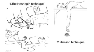 General principles of fracture and dislocation (2).pptx